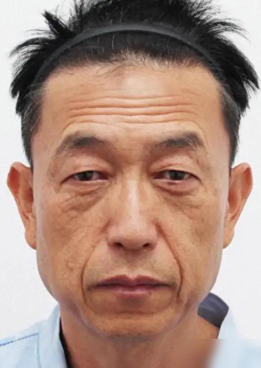 我今年60岁，刚从体制内退休，以前因为工作原因从来都不敢做医美，一次聚会上看到老