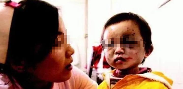 1993年，青海一个五岁的小女孩因偷吃了家里的两块油渣，被自己的母亲惩罚，她将滚