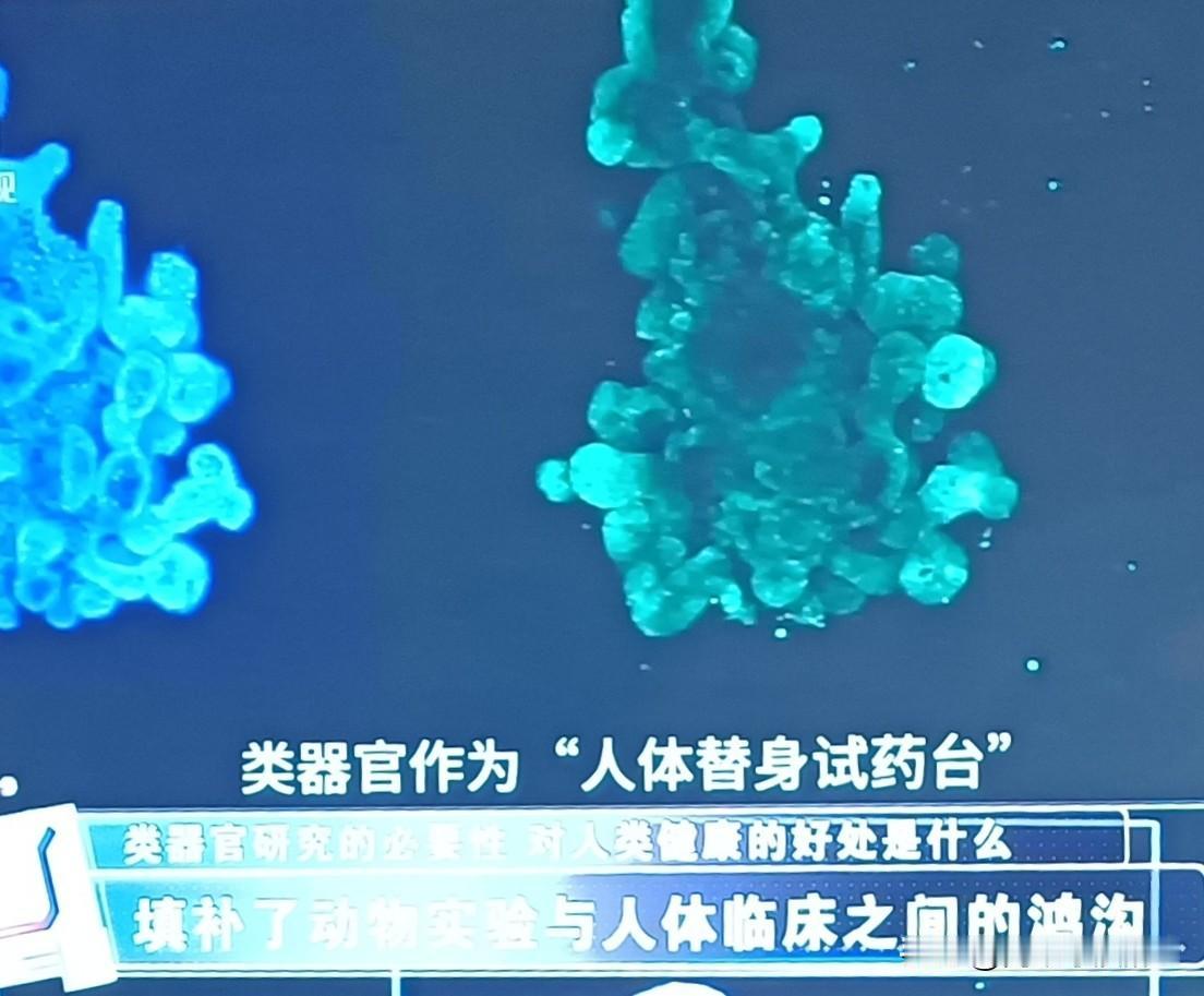 我国已创新某脏器有病可体外“克隆”精准订药，我国类器官研究已实现从跟跑到并跑、局