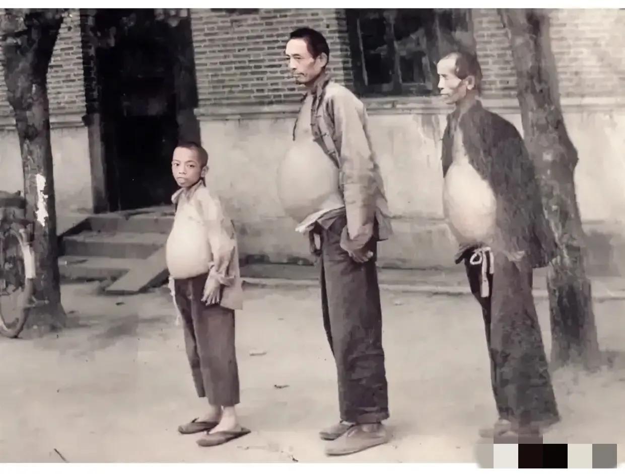 1956年，江苏镇江，一幕令人心痛的景象展现在人们的面前，祖孙三代患上了一种可怕