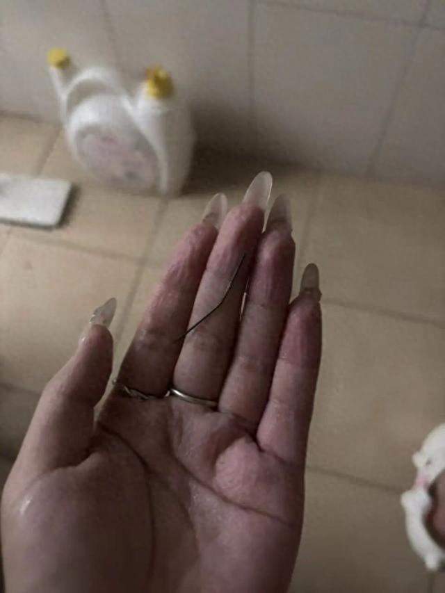 惊！女子臀痛一个月，洗澡竟挤出4厘米生锈针头，医生也震惊！
