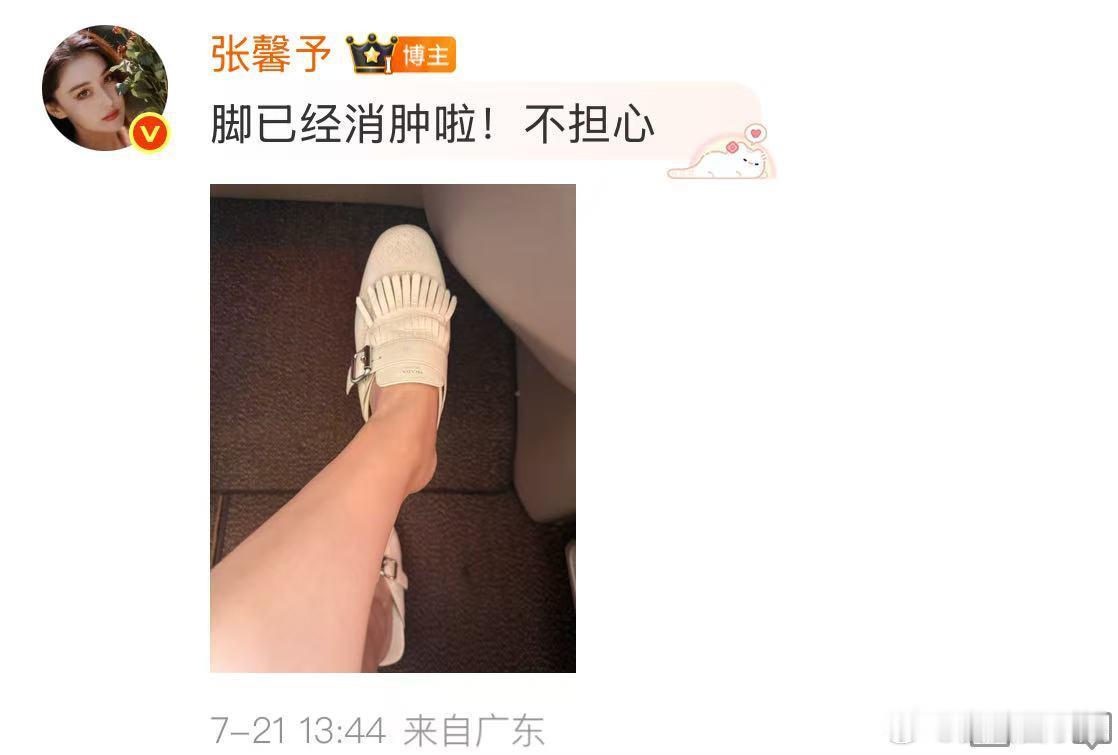 张馨予脚已经消肿啦 张馨予脚已经消肿啦，这就是工作使人消肿吗[doge] 张馨予