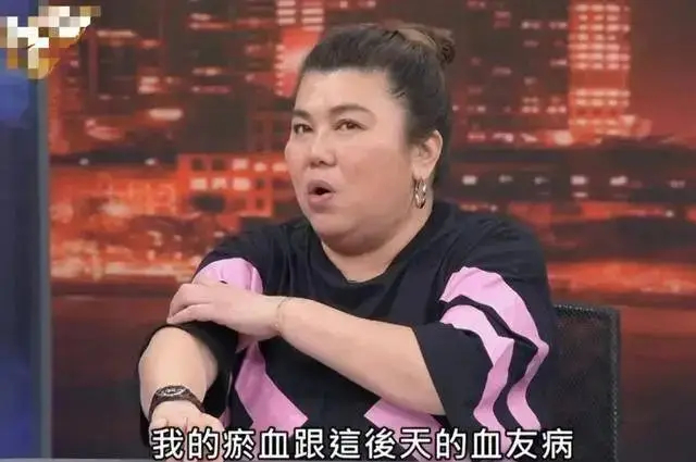 57岁的中国台湾女演员林美秀在节目上自曝患上罕见疾病血友病，甚至已经开始为自己的