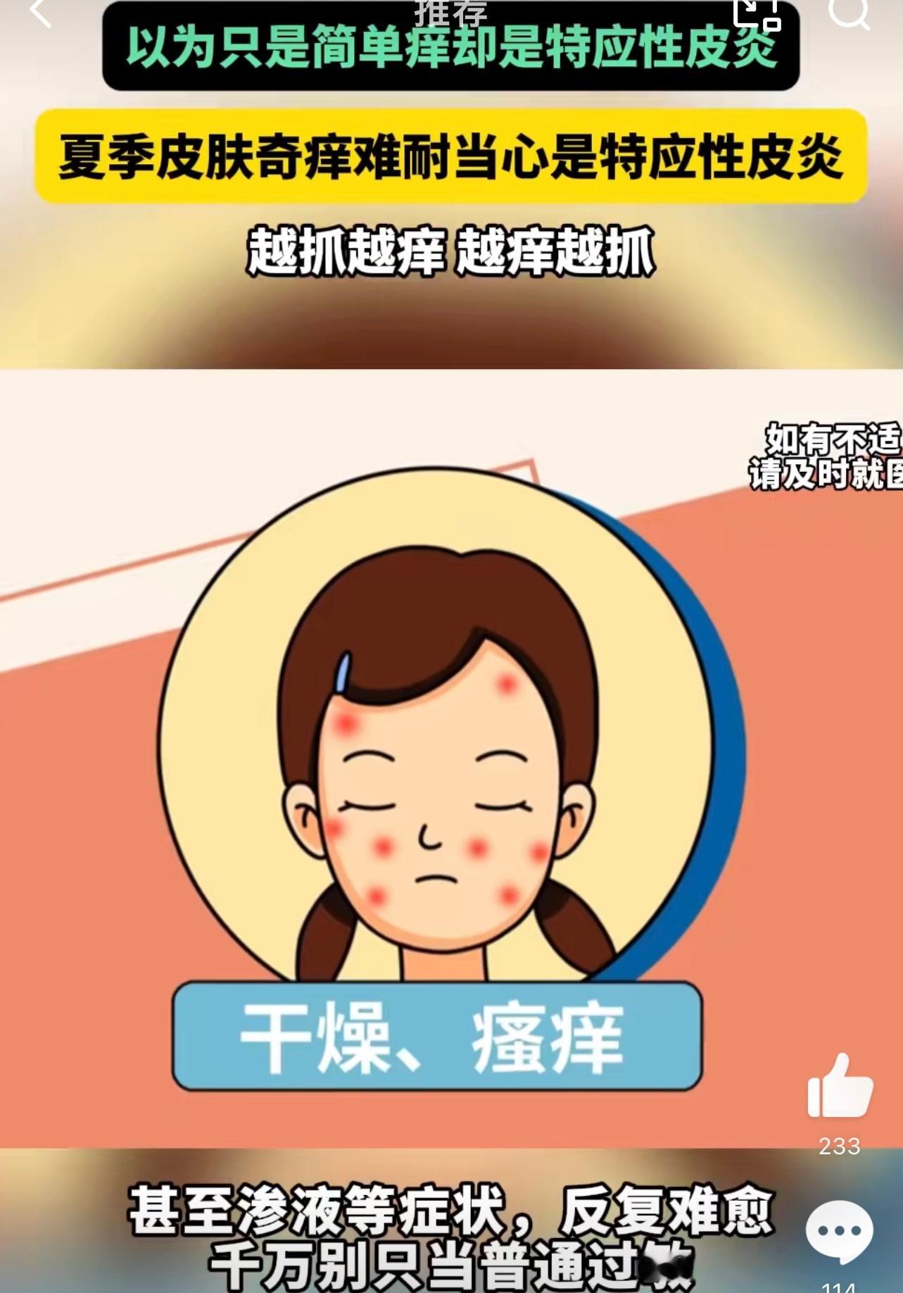 夏季皮肤奇痒难耐当心是特应性皮炎  以前都没有想到原来是这个皮炎的问题，我还以为