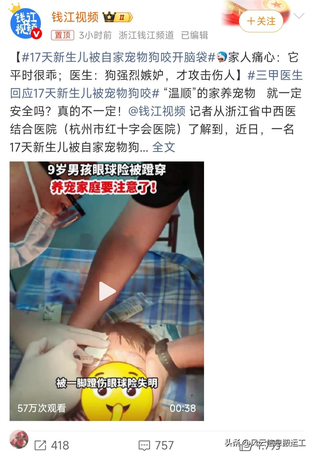 17天新生儿被自家宠物狗咬开脑袋

刚刚出生17天的婴孩，被家里宠物狗咬开脑袋：