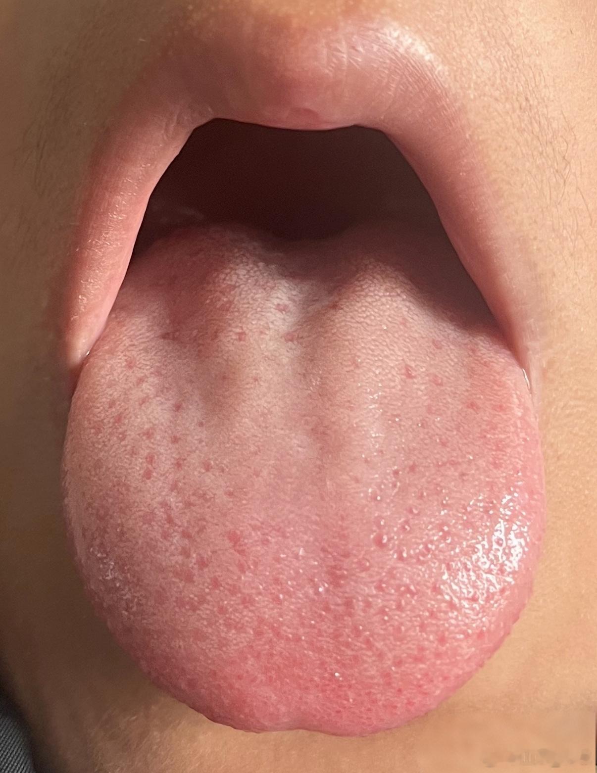 小儿健脾药膳原方是：党参，白术，炒麦芽，炒鸡内金，红枣（剪开），茯苓现在改版后，