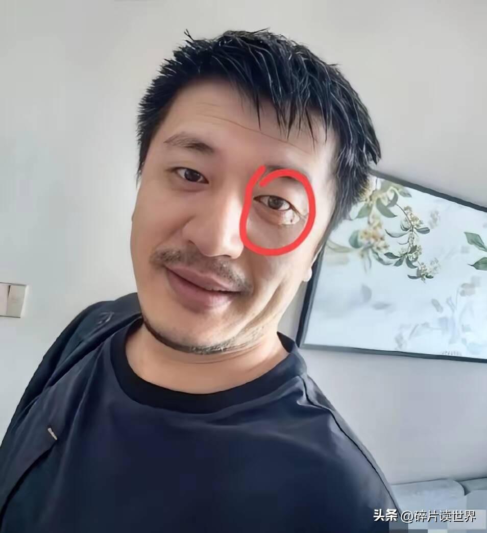 张雪峰身上还有个疑点，想了一夜也没有想通，就是他有专业的护理团队，按说这种事不应