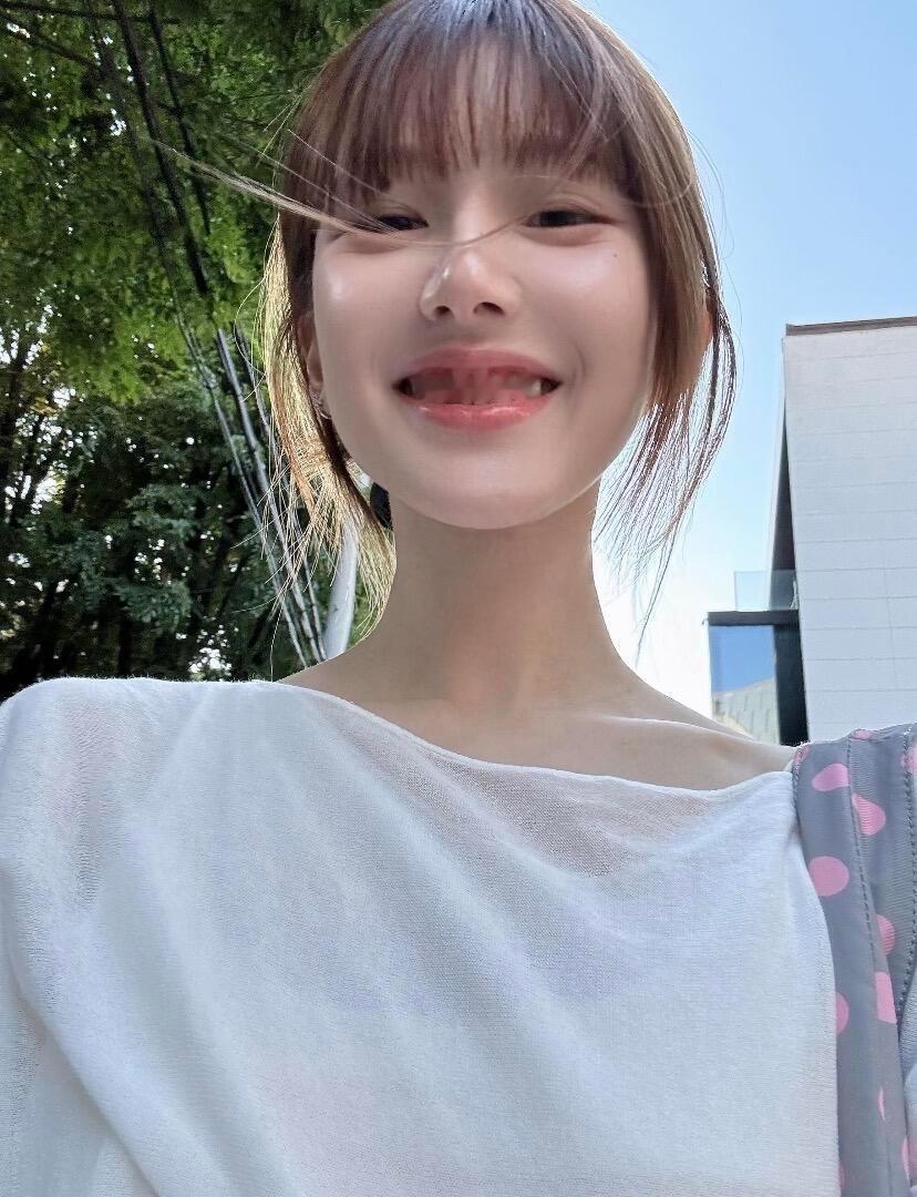 好看的牙弓就会自带明媚气质 牙医太明智惹 把尖尖的牙弓扩开 阔面本身位置也够~ 