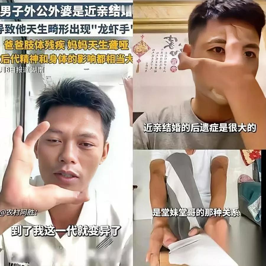 近亲结婚有多可怕？看完窒息

湖南一90后男子太惨了！外公外婆是亲堂兄妹，妈妈天