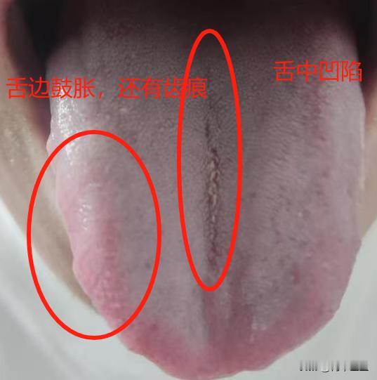这位朋友，真是“财大气粗，花钱如流水”啊，明明调理很简单，非要花大把的钱去补，这
