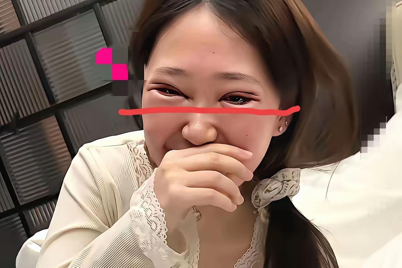 这位女士可真有魄力，
花一千元做了双眼皮美容手术。
如今手术已经顺利完成，医生说