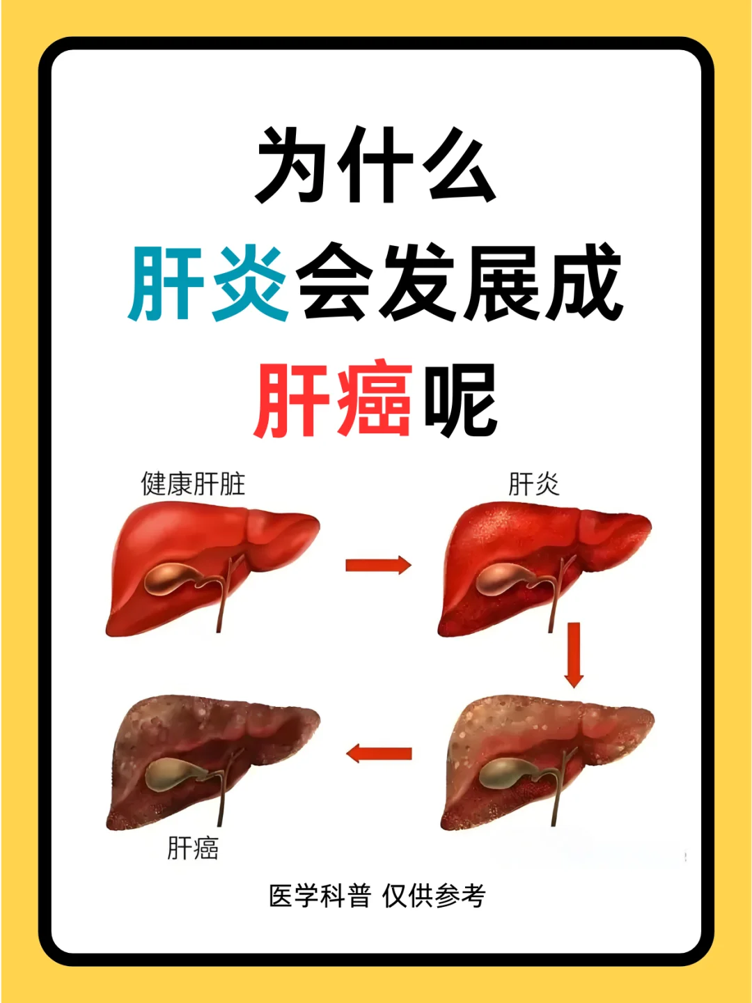 为什么病毒性肝炎会发展为肝癌呢？