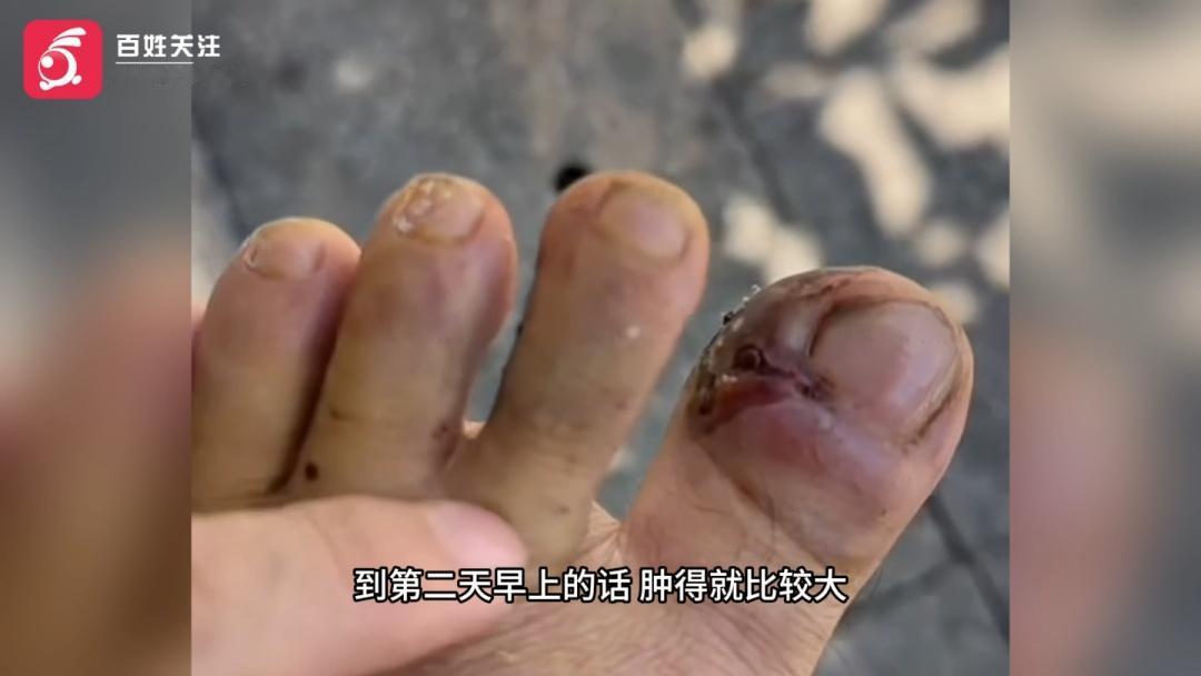 悲剧还是发生了！四川广安，一名男子深夜前往水田捕捉小龙虾，没抓到几只，反倒遭到暗