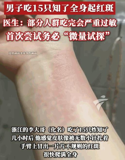 飞来横祸！7月6日，浙江一位男子美滋滋地享用了一盘时令野味“炸知了”之后，竟是浑