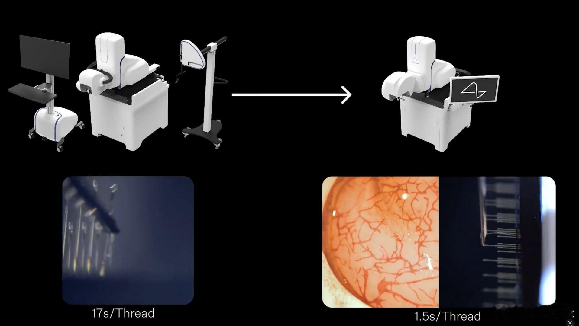 Neuralink已准备好首次将其新型脑机芯片Blindsight植入人体（待监