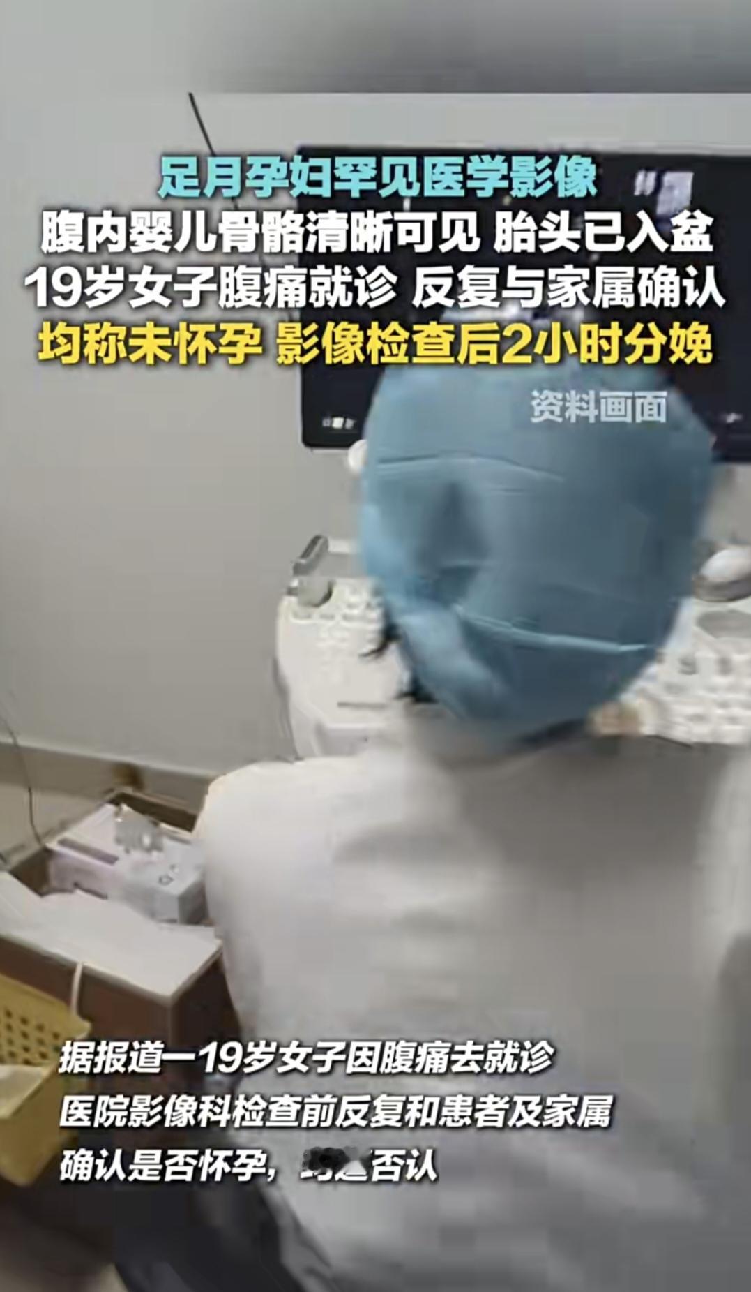 腹痛就医的19岁女子，两小时后分娩足月胎儿
近日，一名19岁女子因腹痛就医，本人