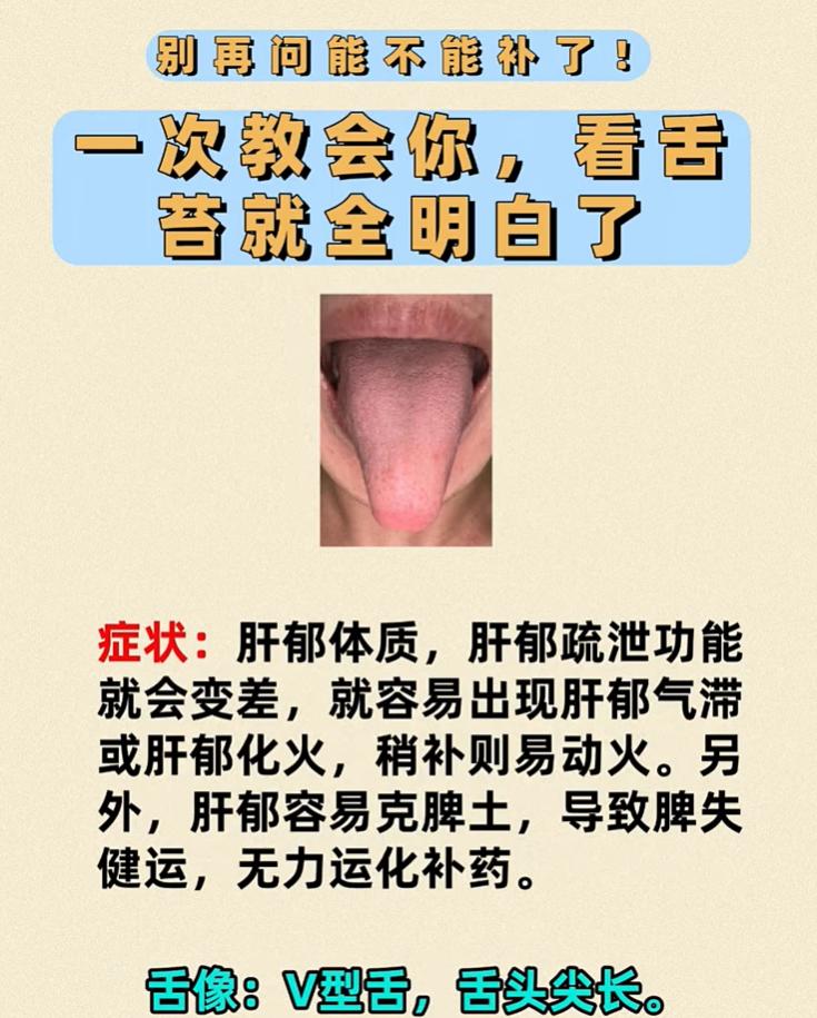 一补就上火？5 种舌象告诉你，哪些体质不能盲目进补