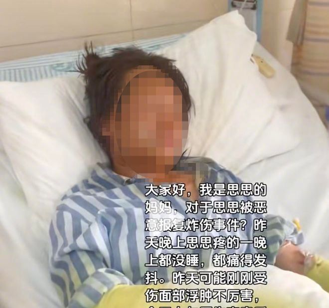 【女主播被快递炸伤案细节曝光：被告自制爆炸装置，多次趁女主播直播时作案】男子多次
