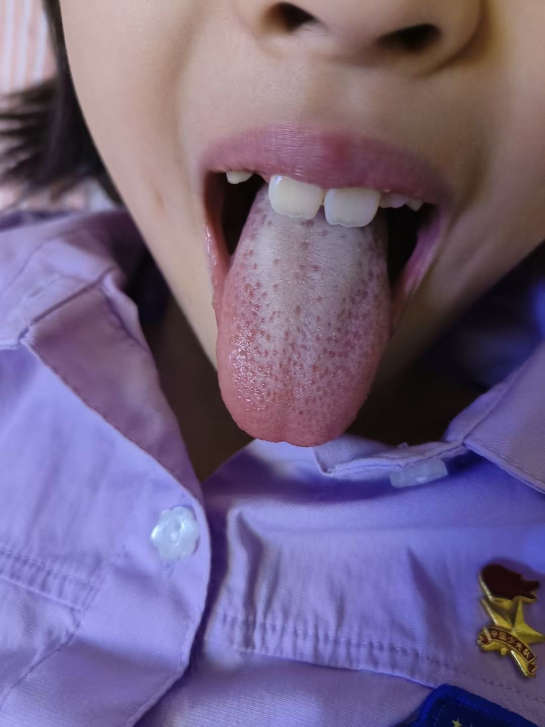 #中医##育儿专家说##康尧小儿推拿# [心]脾虚的五大表现：1、说梦话、磨牙、