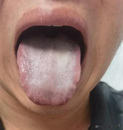 小小年纪，这看的我有点心疼啊，压力这么大干嘛[泣不成声][泣不成声][泣不成声]