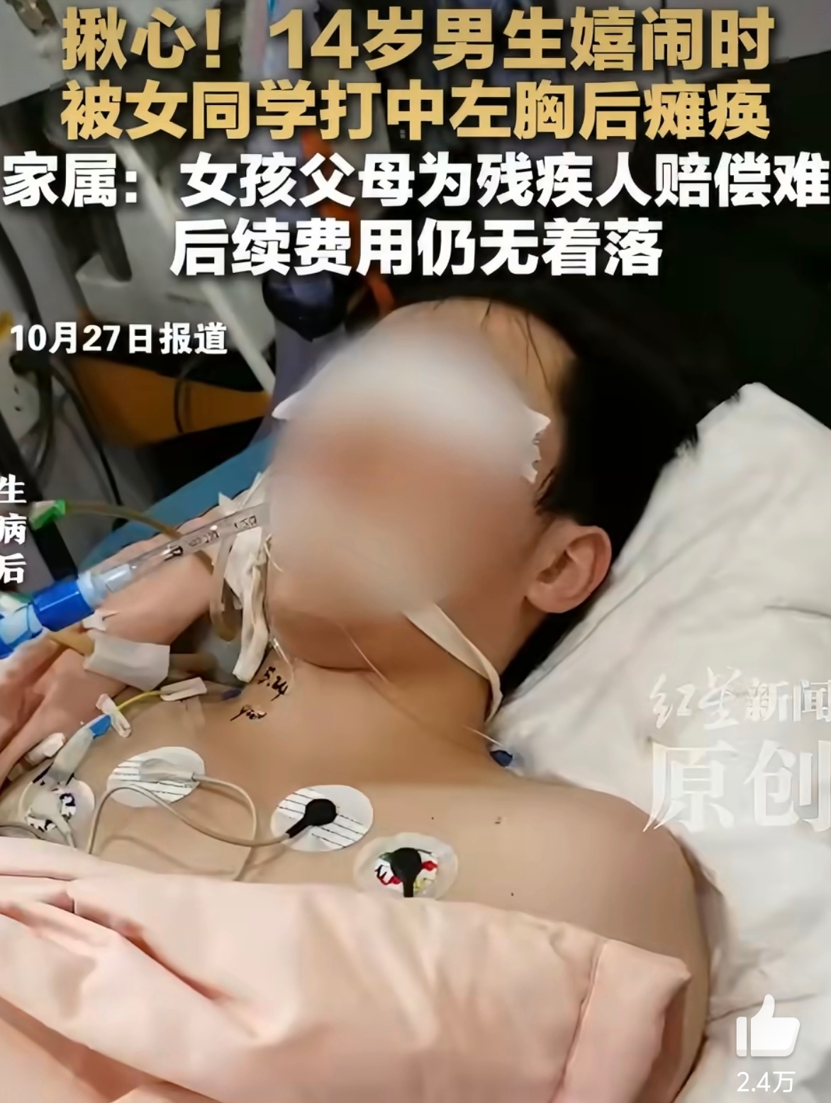 14岁男生被女同学击中左胸后瘫痪没有买意外险吗？意外险是可以边治疗边赔付的，不需