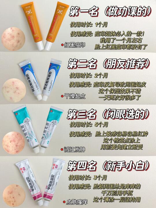 重度痘印请进！一篇看懂痘印怎么去除!