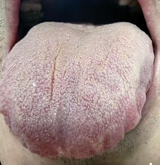 中年元气提振乏力切勿盲目进补，调补脾肾才是根本之道






有不少男同志上了