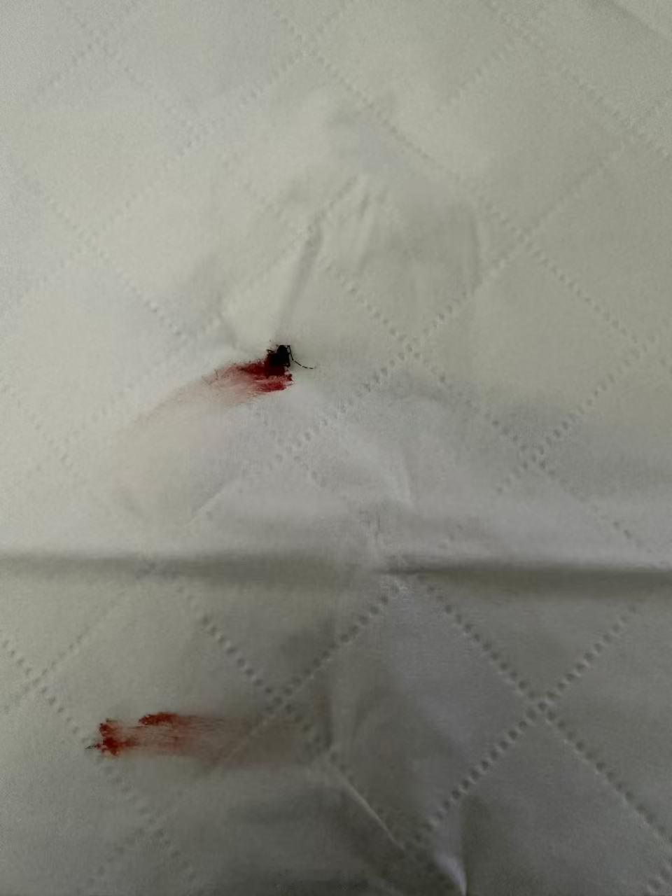 这个白花蚊子吸我的血吸撑了飞不起来了 ​​​