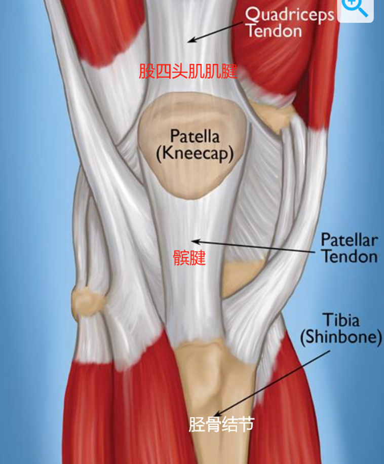 髌腱炎  再发一张包含膝关节的解剖图，不过这次的重点是——股四头肌肌腱病股四头肌