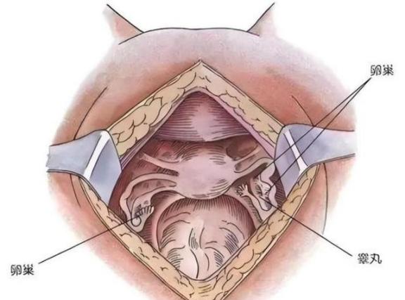 1965 年，重庆一“女子”拥有两套生殖系统，她十八岁先是嫁老公生下一子，后竟然