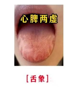 很多人拿着一盒附子理中丸，吃下去却像石沉大海，甚至有人越补越觉得浑身燥热。
其实