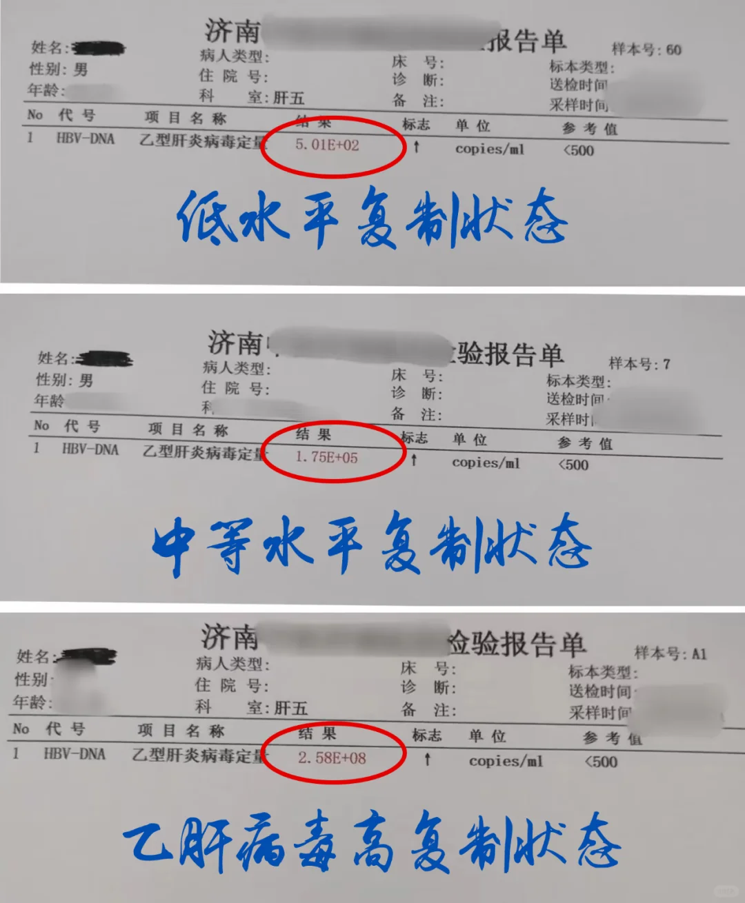 乙肝病毒复制水平怎么看？