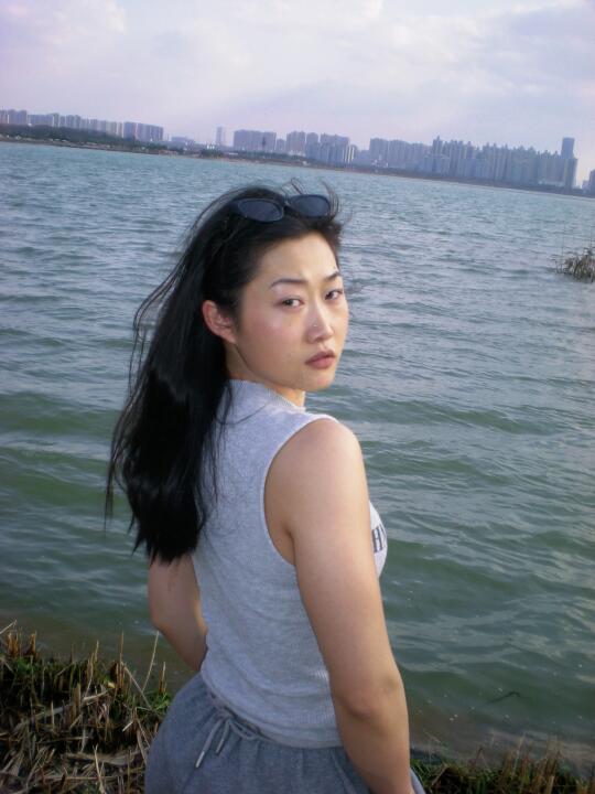 95长沙正畸，从凸面型到自然侧颜仿佛换头