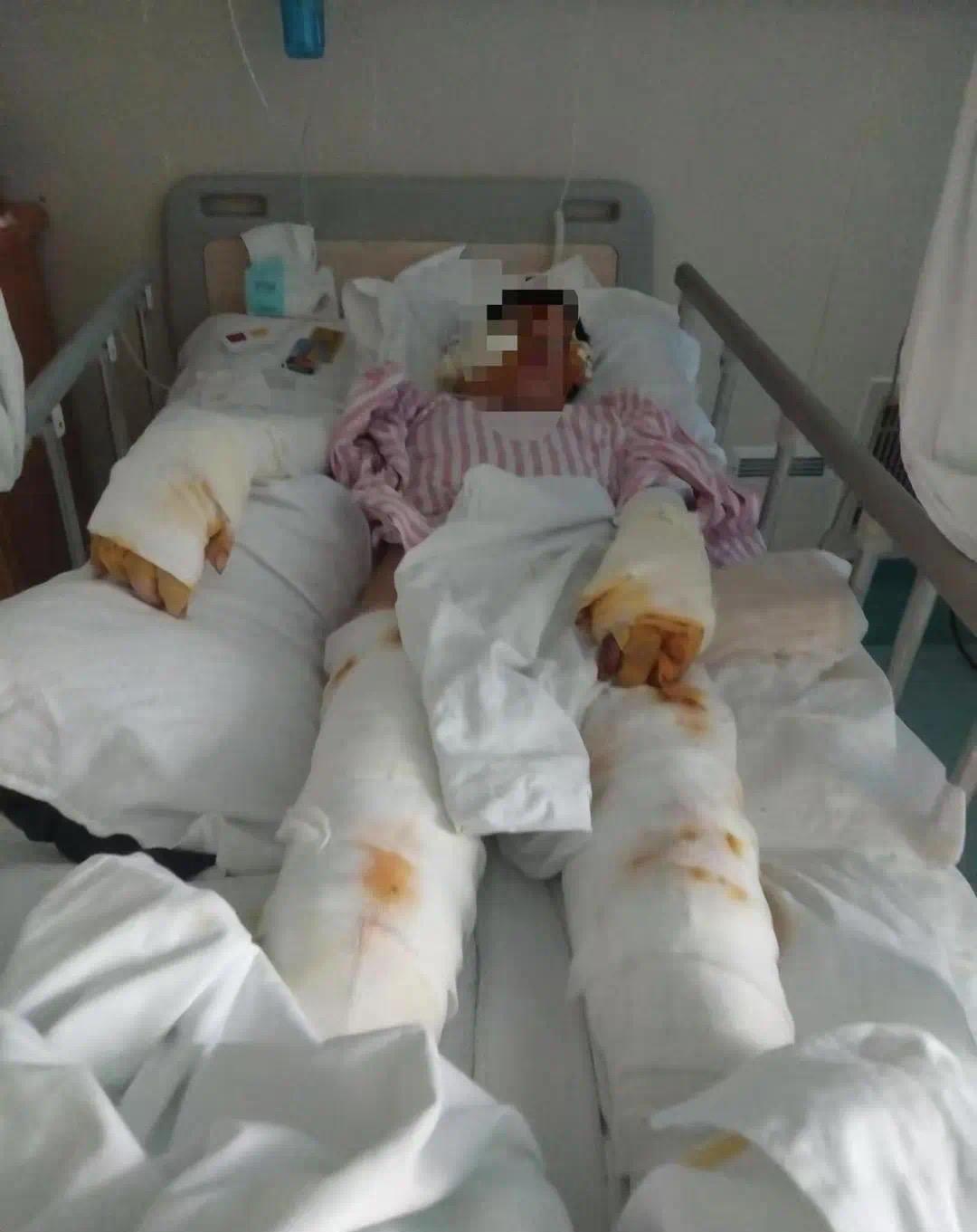 顺风车女司机被乘客求爱不成，硫酸毁容刺成重伤，这件事的教训是女生不要轻易向人透露