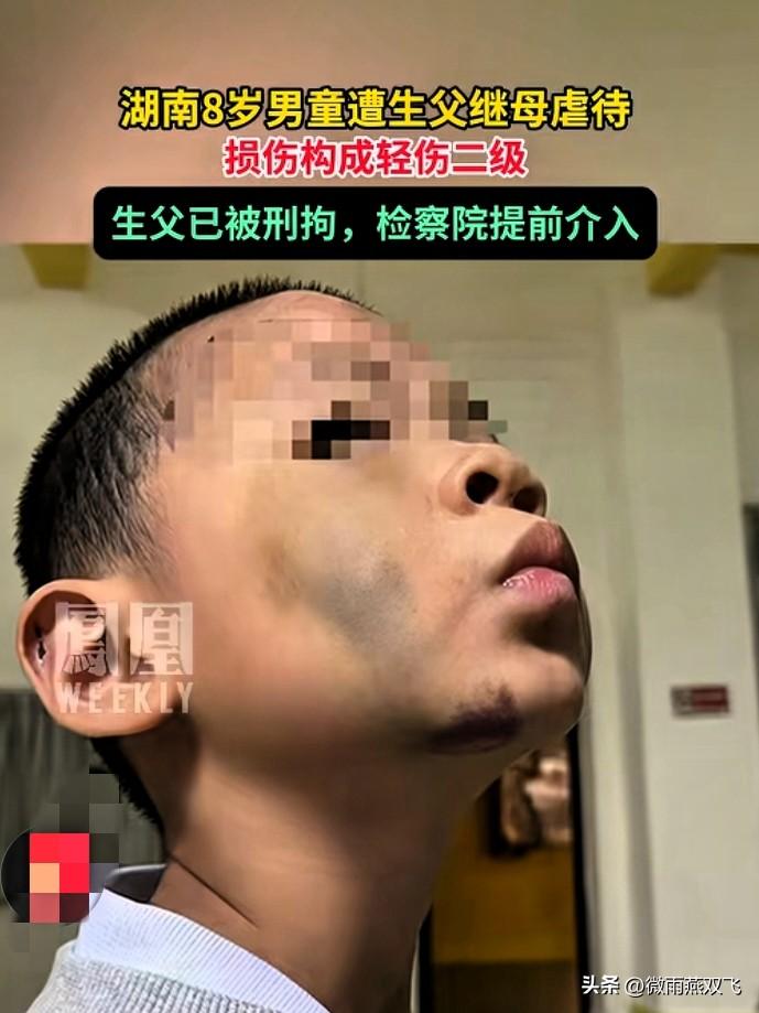 湖南武冈虐待两姐弟的继母，这个女人不简单。

她的手段之残忍，令人发指，可以说，