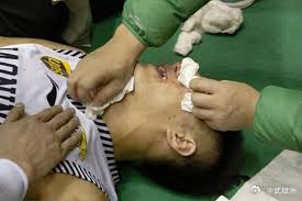 郭艾伦左膝又崩了！复出战末节突破瞬间倒地，担架抬走那一刻广州体育馆死寂一片补赛对