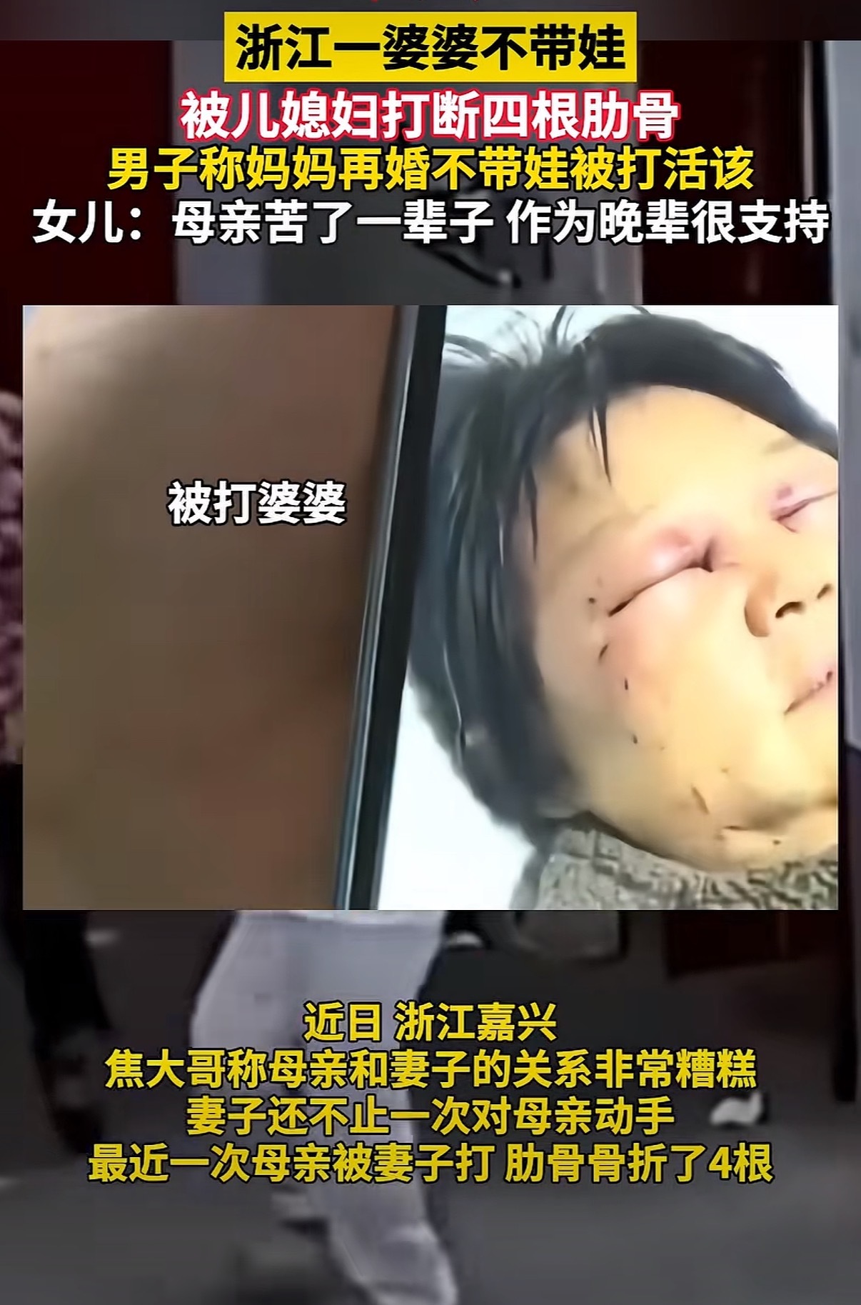 男子称妈妈再婚不带娃被打活该 打断了四根肋骨。。。不知道的还以为是仇人，人都辛辛