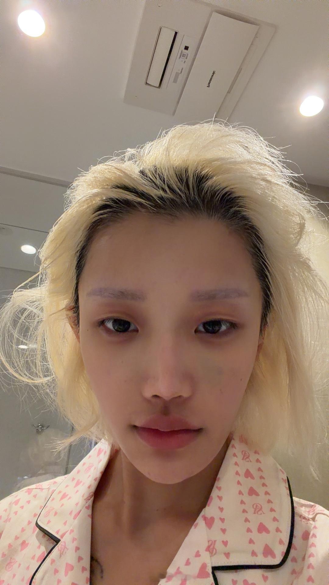 胃病又发作了 吃啥吐啥 