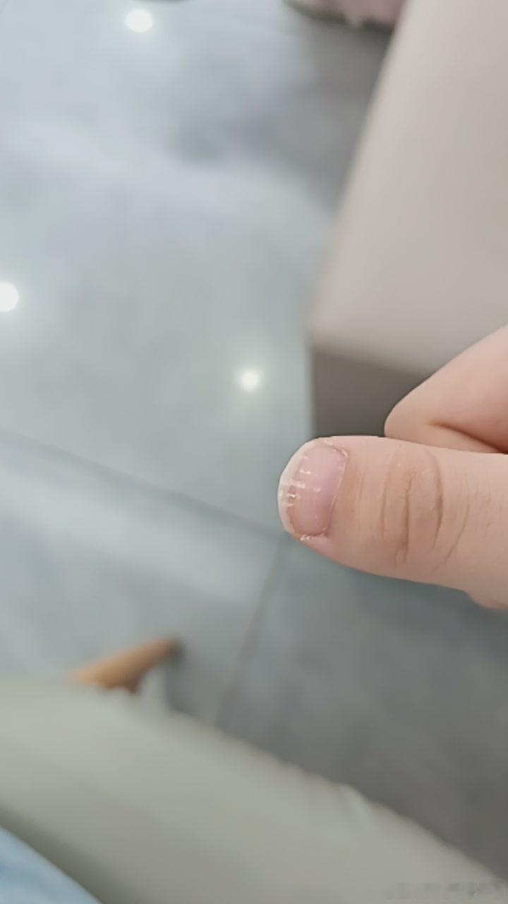 💅🏻37841这种指甲做建构会好一点吗 