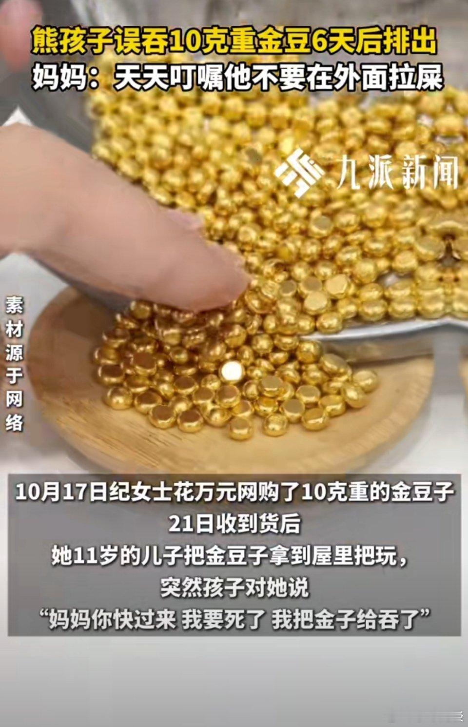 熊孩子误吞10克金豆6天后排出这下真是“屎贵屎贵”了[笑cry] ​​​