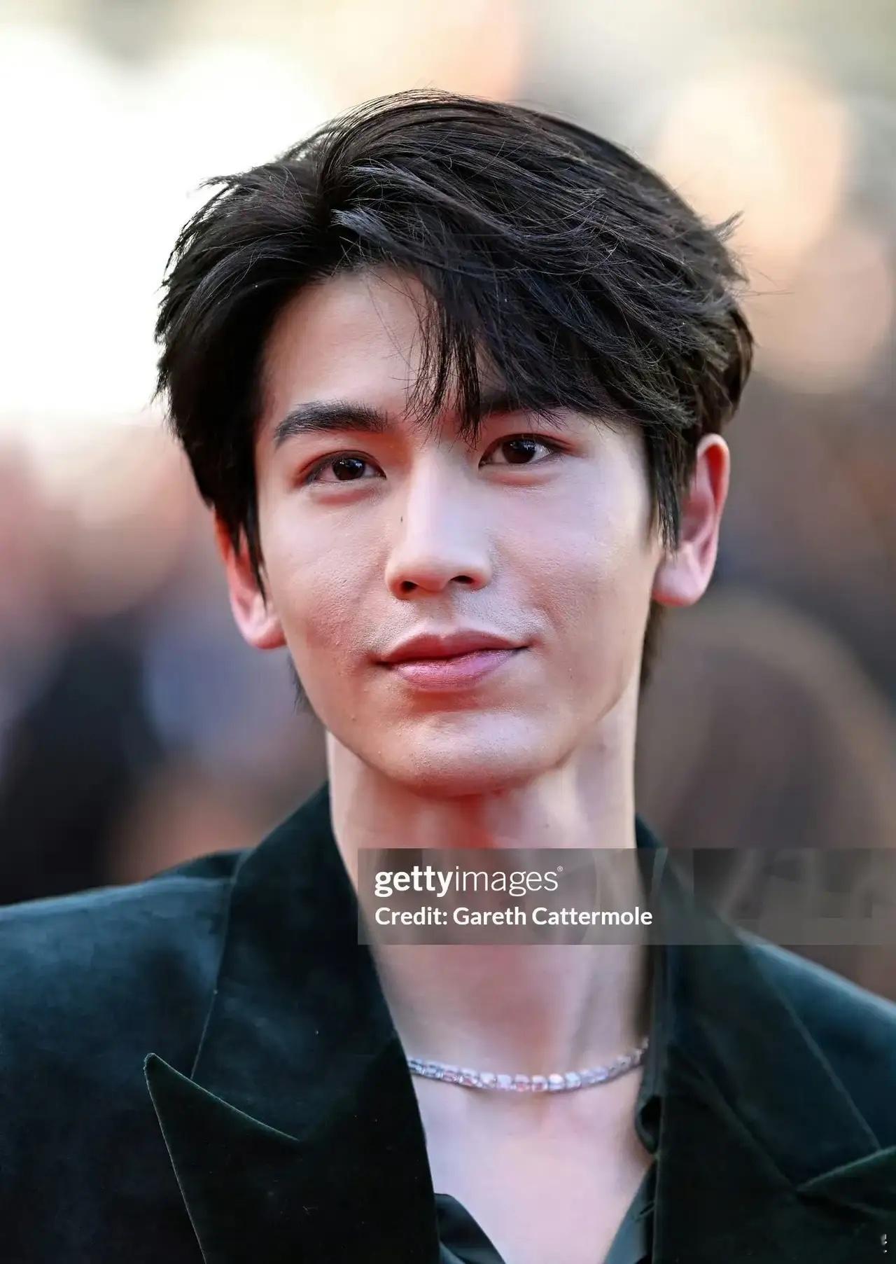 张凌赫皮肤是不是变好了他的五官底子非常好，身材高挑，外形方面唯一劣势就是皮肤褶子