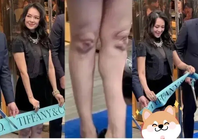 汪峰两任女友，腿上都有淤青，这巧合看着有点怪啊？汪峰爱穿皮裤，不管别人说像灌香肠