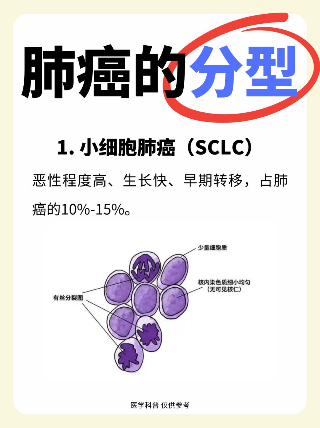 肺癌有哪几种分型？