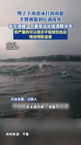 “悲剧还是出现了！”山东青岛，一男子下海游泳期间，不小心打到了海蜇，结果就被海蜇