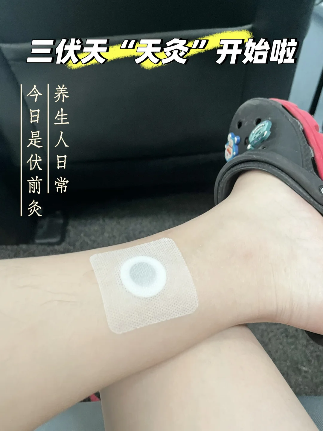 今天去做了伏前灸🔥年轻人的养生DNA觉醒了