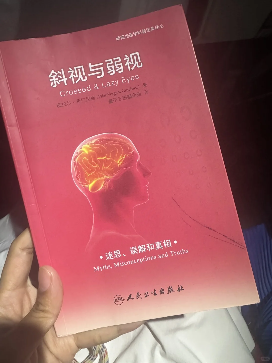 宝妈们，斜视不做手术到底会不会好？
