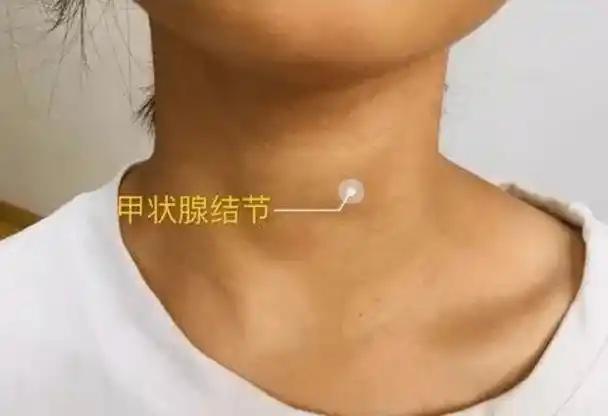 我有个发小叫林晓，30岁不到就做到公司中层，前阵子却在体检中心哭成了泪人。
 