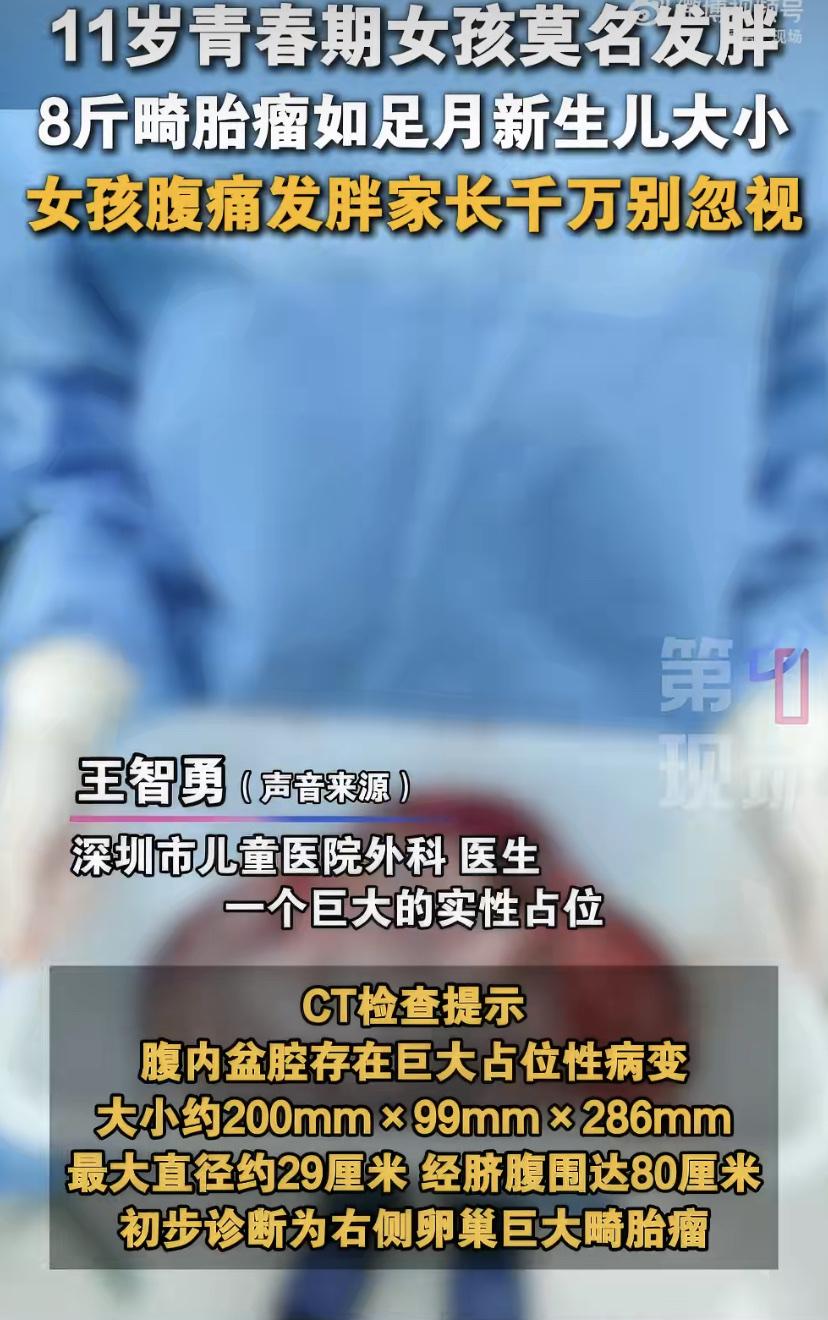 深圳11岁女孩肚子慢慢变大，家里人还以为是长胖了，没太当回事。结果6月初，孩子在