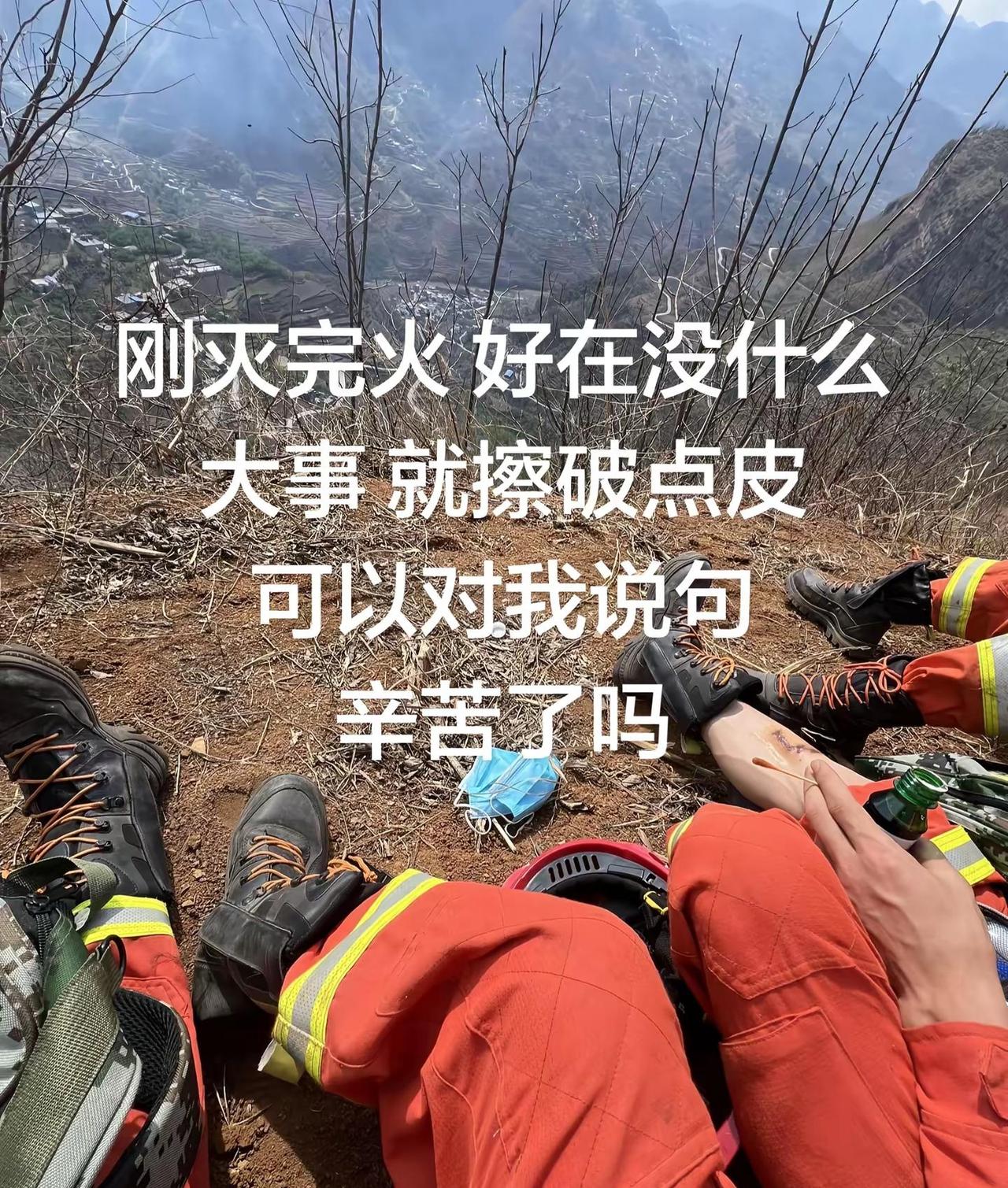 刚灭完火 好在没什么大事 就擦破点皮可以对我说句辛苦了吗消防员