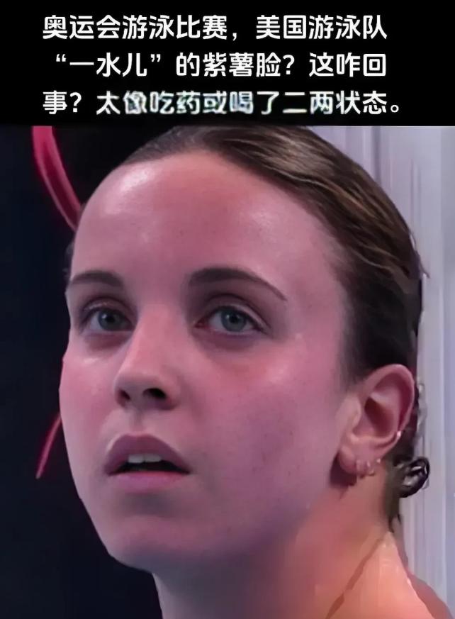美国游泳队宣称集体食物中毒，然后申请新加坡游泳世锦赛集体医疗豁免。看样子是磕药的